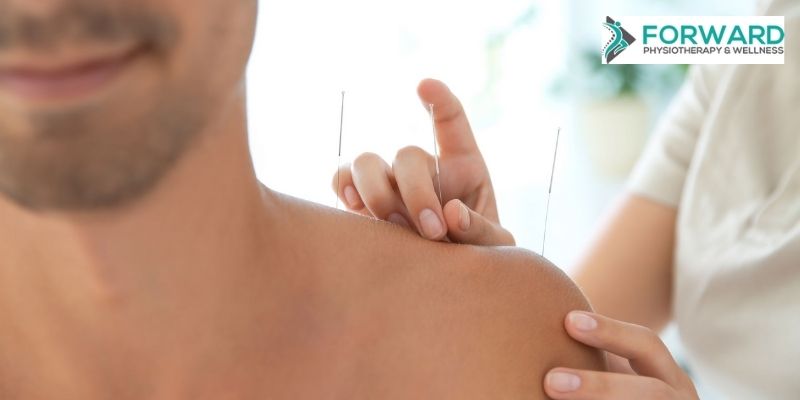 Ways Acupuncture Boosts Your Overall Wellness