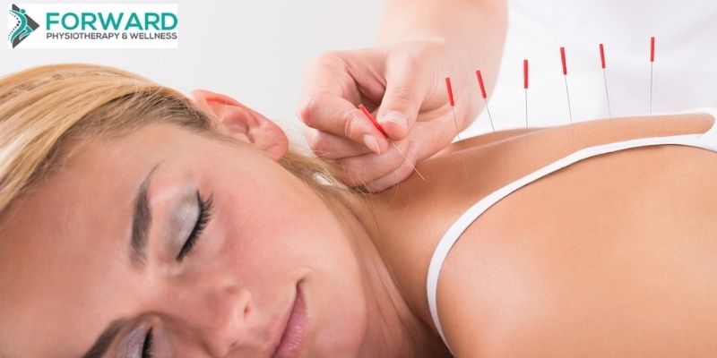 Acupuncture For Menopause