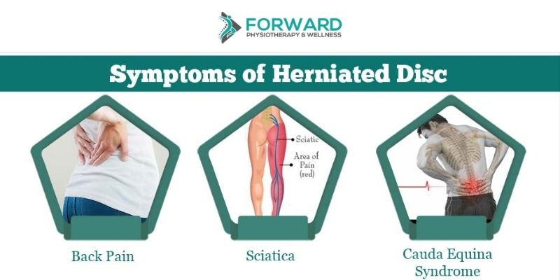 What Is a Herniated Disc and What Can You Do If You Have One? -  Chiropractic Health and Wellness